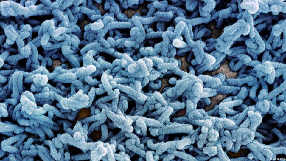 السلطات الإثيوبية تؤكد تفشي وباء “ماربورغ” في جنوب البلاد