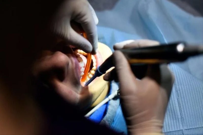 “كنوبس” تلغي شرط “الموافقة المسبقة” لملفات تعويض أطقم الأسنان