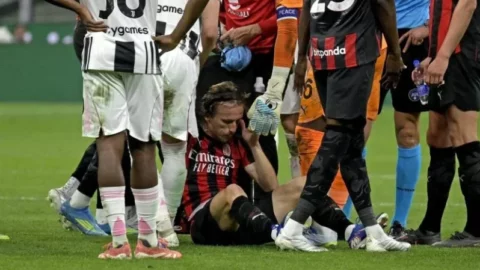 مودريتش سيخضع لجراحة بعد تعرضه لكسر في عظم الوجنة